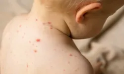 Risk grubundakiler için hayati tehlike olabilecek hastalık!