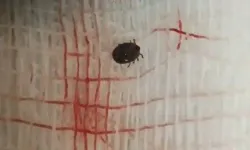 Kene Vakası Can Aldı
