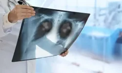 Gençlerde Daha Sık Görülüyor! Bu İki Belirtiyi Sakın Hafife Almayın