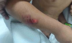 Sokak Köpekleri İlkokul Öğrencisine Saldırdı: Başına 15 Dikiş Atıldı