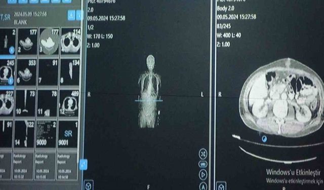 Van'da Yapay Zekâlı Tedavi Sonuç Verdi!