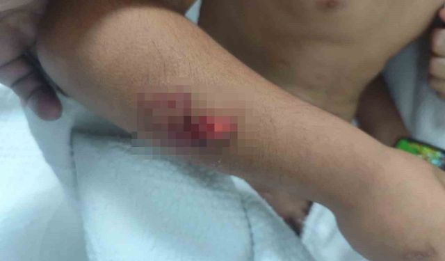 Sokak Köpekleri İlkokul Öğrencisine Saldırdı: Başına 15 Dikiş Atıldı