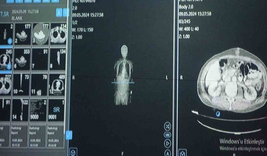 Van'da Yapay Zekâlı Tedavi Sonuç Verdi!